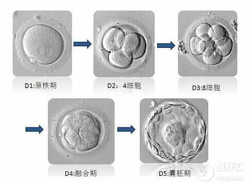 美國試管嬰兒對胚胎移植數(shù)量有要求嗎？