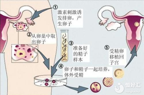 試管嬰兒很難承受的是這3點，別過于相信謠言