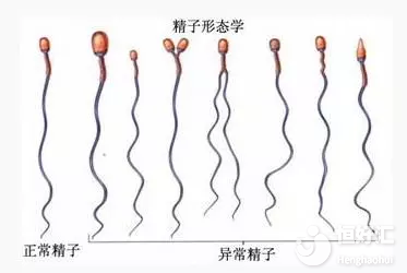 試管嬰兒畸形率高嗎？這2點才是“不為人知”的一面