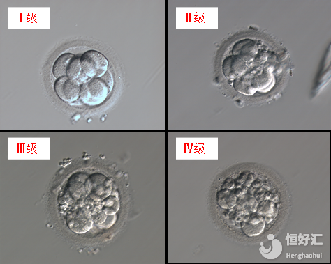 3分鐘看懂試管胚胎等級區(qū)分，有利提高成功率！