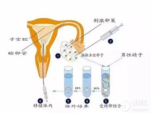 試管嬰兒取卵需要多長時間？或許沒你想的復(fù)雜