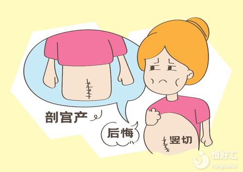 剖腹產(chǎn)后出現(xiàn)的3大危險行為，你都占了嗎？