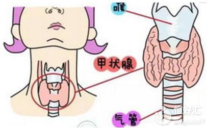 試管嬰兒為什么要查甲狀腺功能？醫(yī)生：圖的是這個